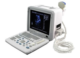 XF300 LED Portable Ultrasound Scanner