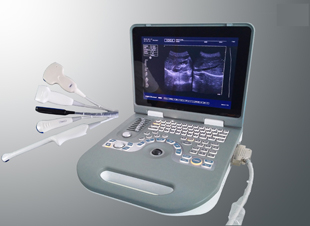 New model  B/W laptop Ultrasound Scanner System launched
