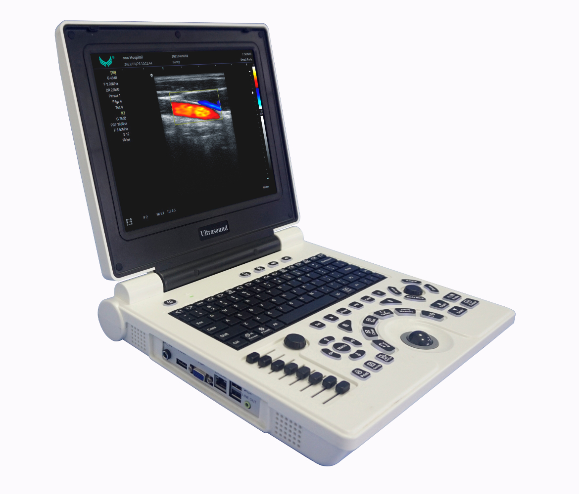 E20 Notebook Color Doppler Ultrasound Scanner
